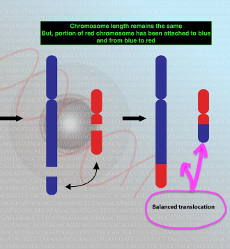 Balanced translocation and risk of recurrent miscarriage.