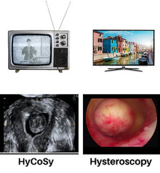 HyCoSy and Hysteroscopy