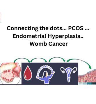 Connecting the dots... PCOS ... Endometrial Hyperplasia.. Womb Cancer