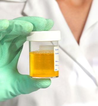 How long for urine test results in NHS