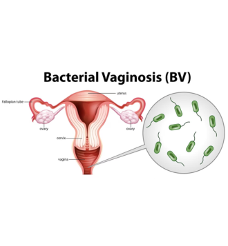 Bacterial Vaginosis treatment in London